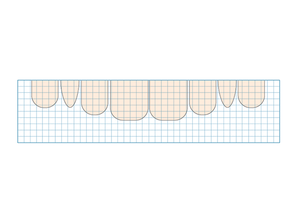 Another Use for Dental Molding